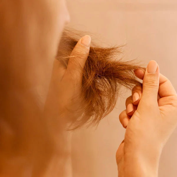 Treats dandruff and itchiness